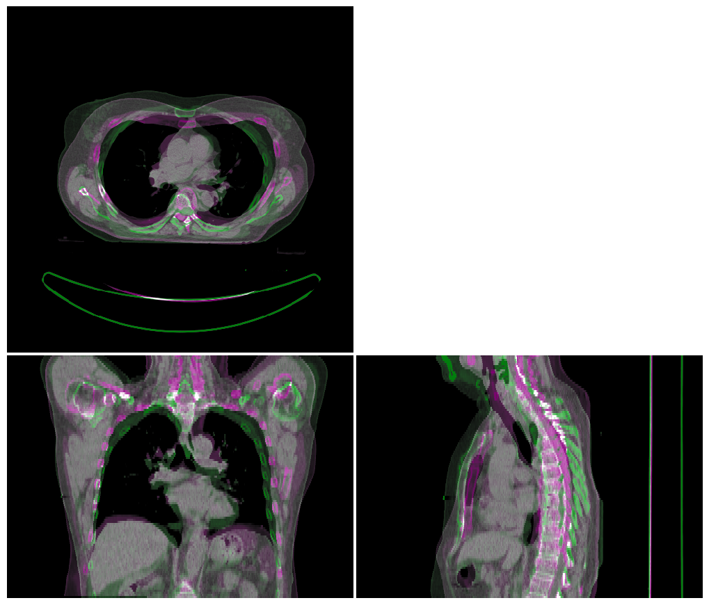 ../_images/_examples_atlas_segmentation_12_0.png