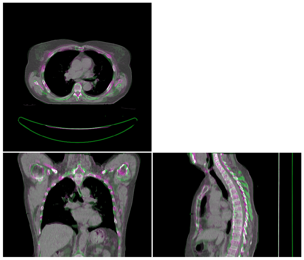 ../_images/_examples_atlas_segmentation_14_0.png